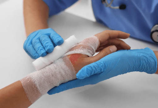 How Compensation Works in Serious Burn Cases